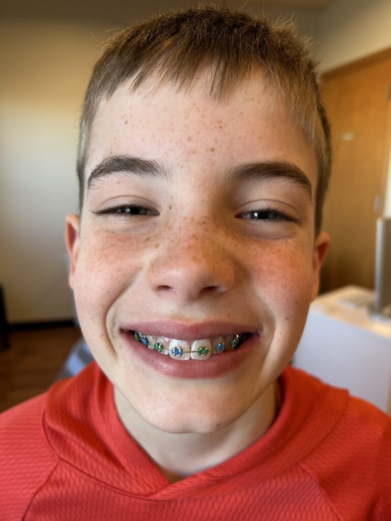 Jack and his new braces!